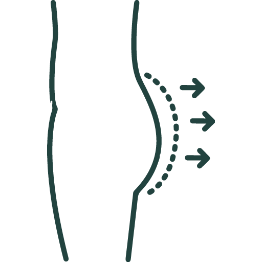 Buttock Augmentation